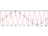 エイリアシング